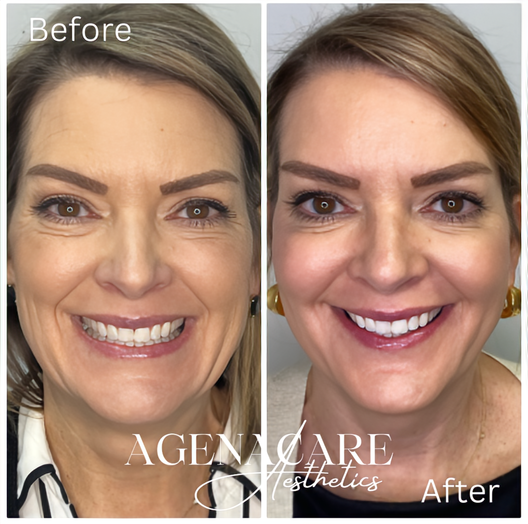 Side-by-side image of before and after skincare product.