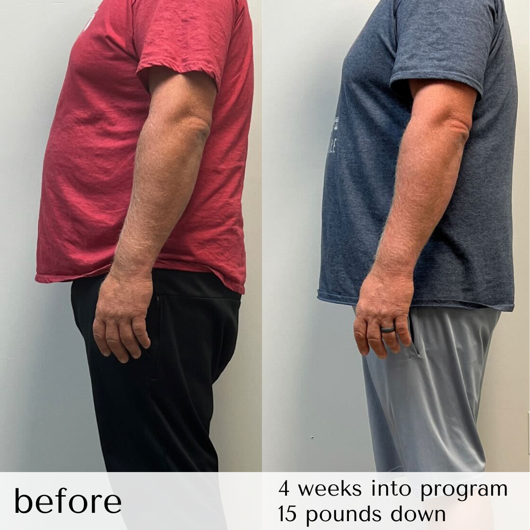 Weight loss in Roanoke and Danville — Agenacare Aesthetics