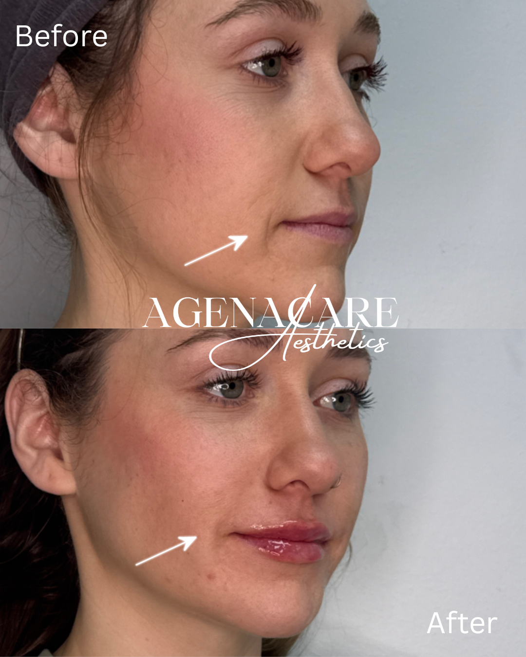 before and after- without arrow.png