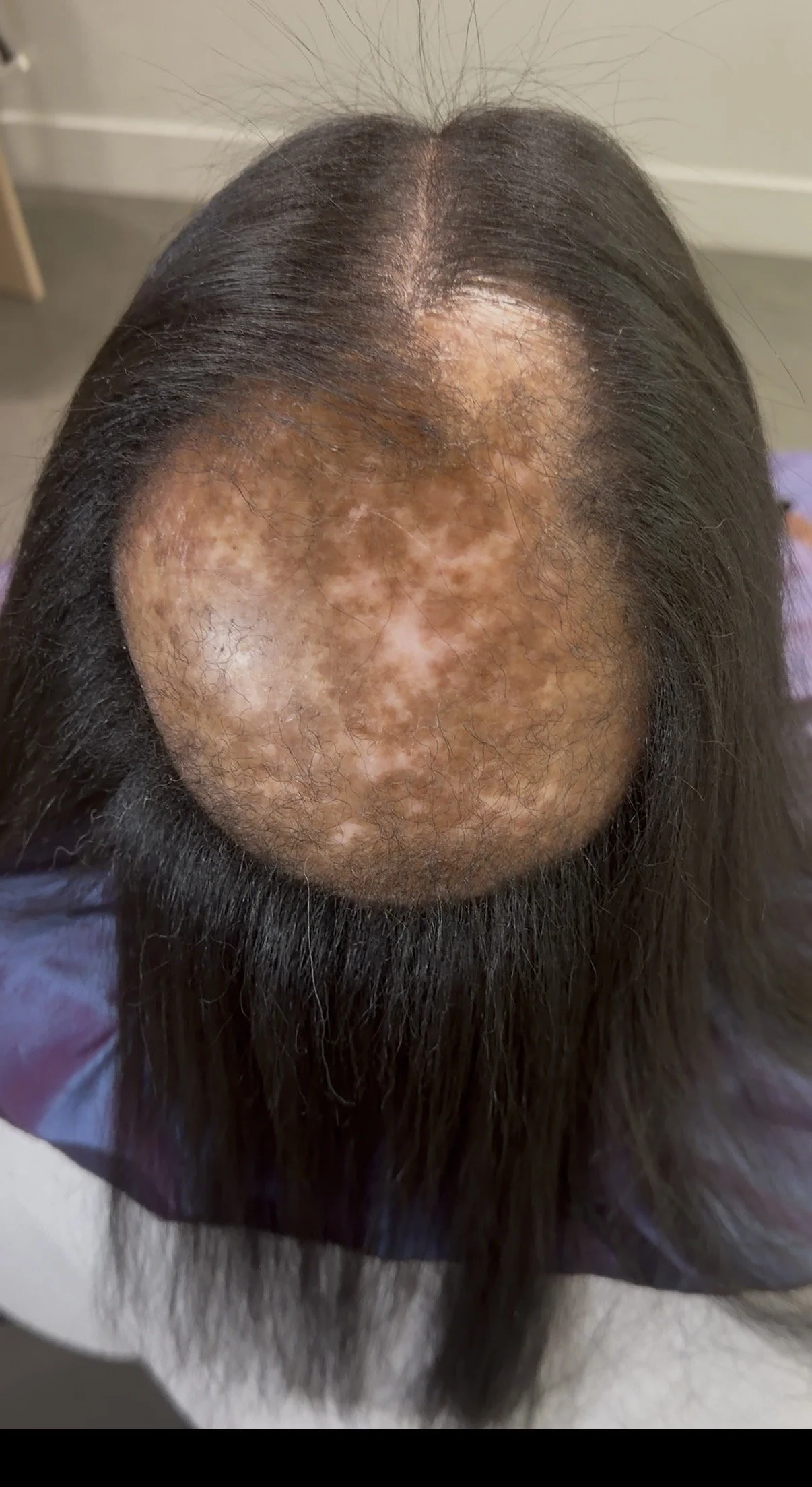 Client 1: Before 