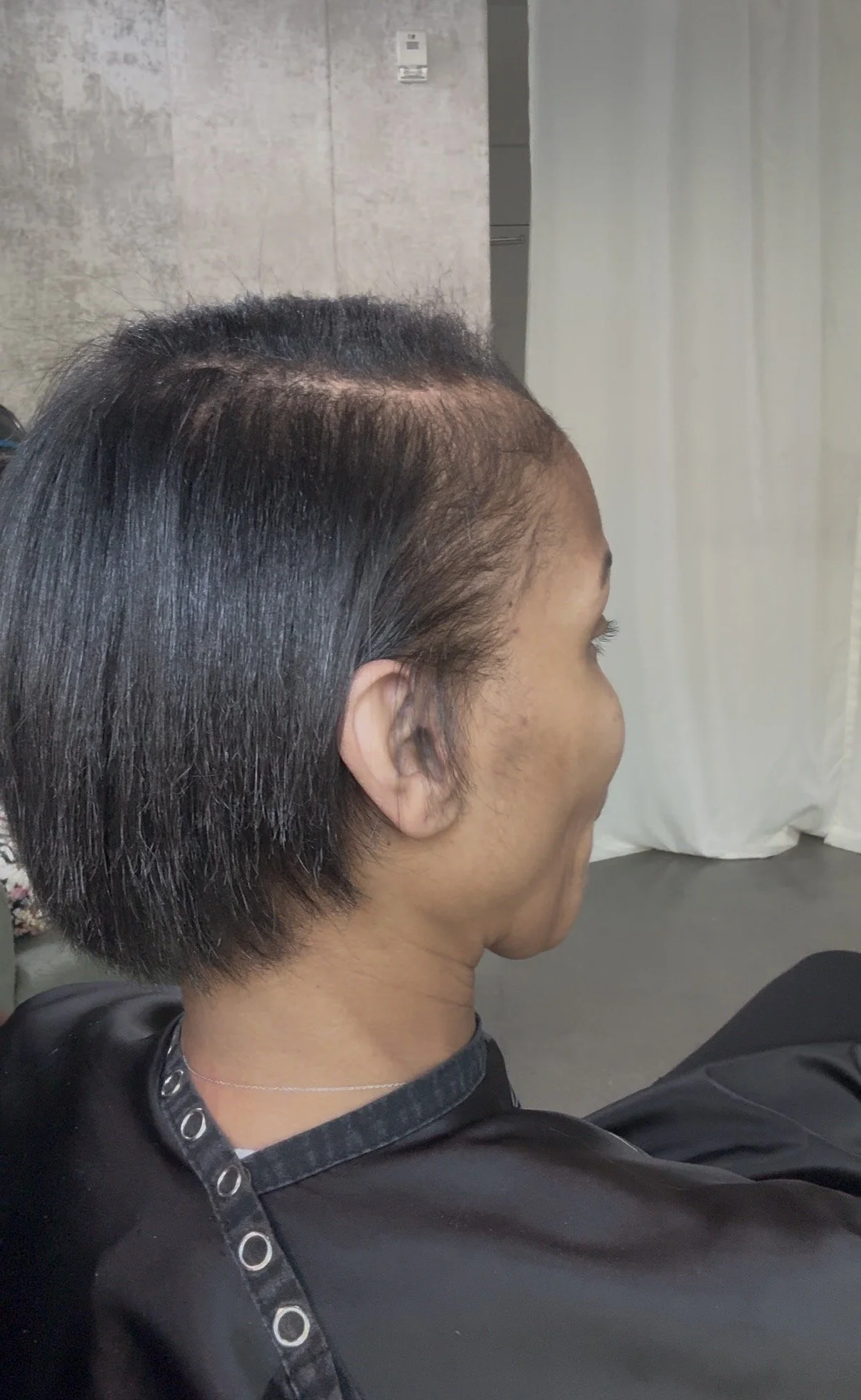 Client 6: Before
