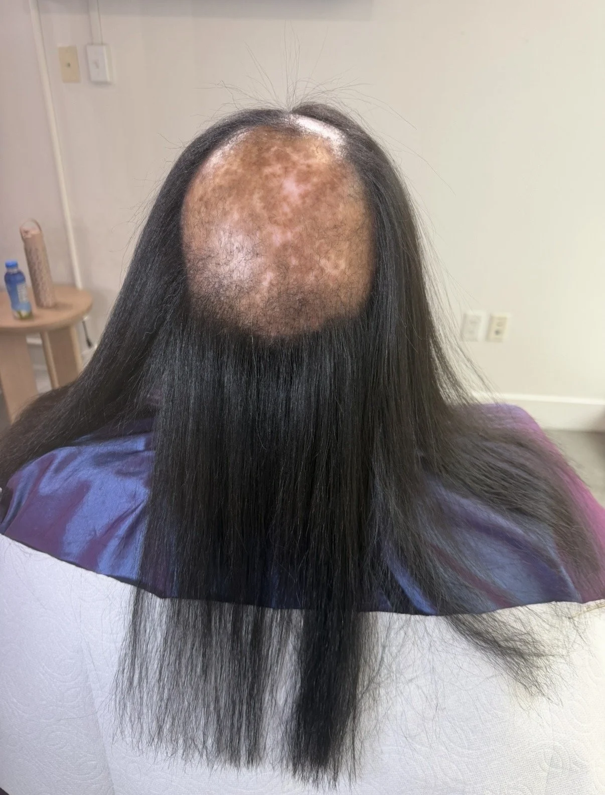 Client 1: Before 