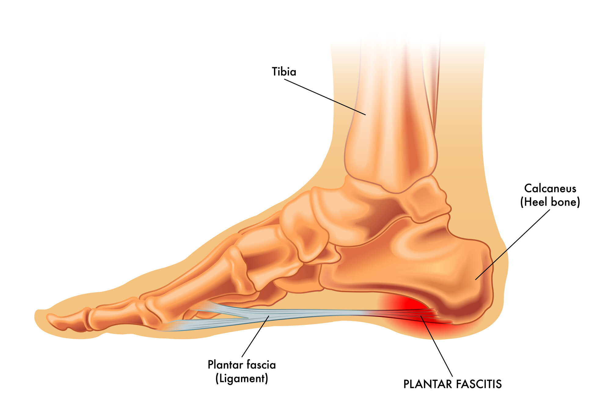 When is revision surgery required for ankle replacements?