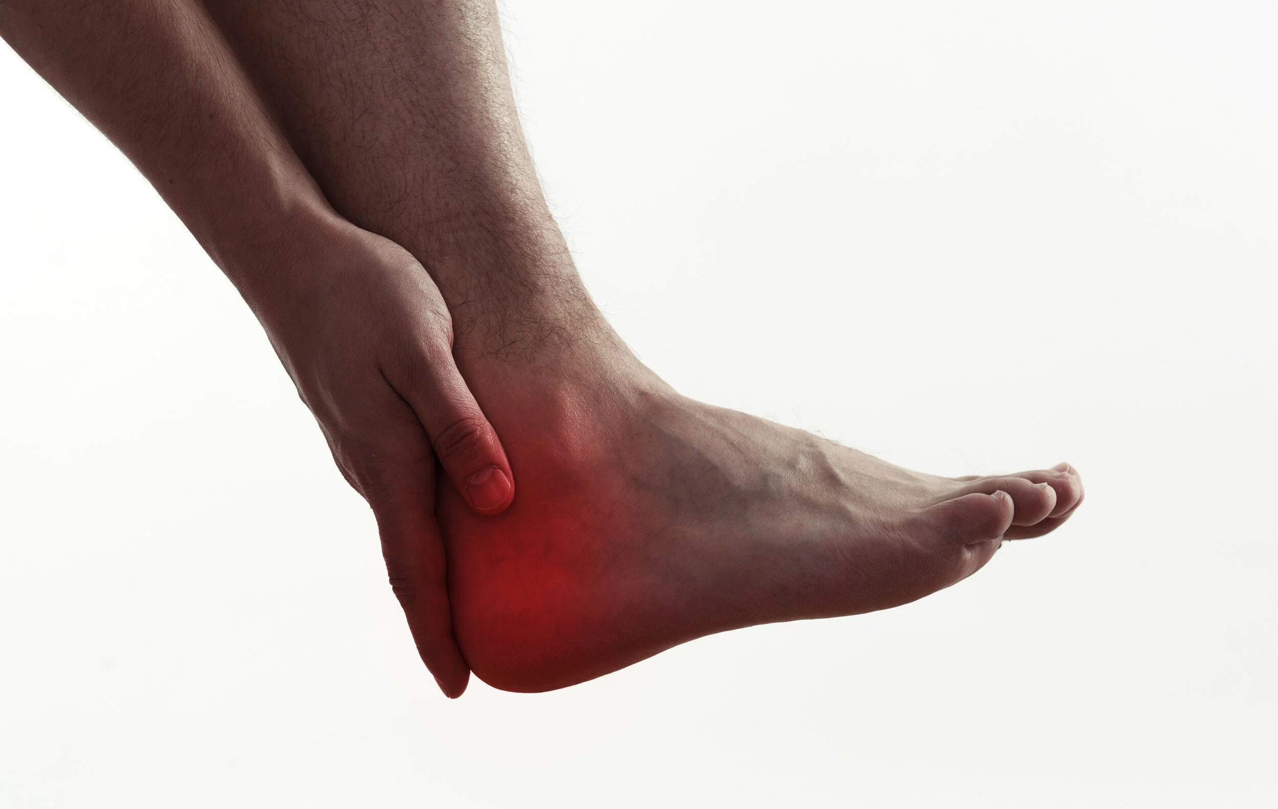 What Is Tarsal Tunnel Syndrome?