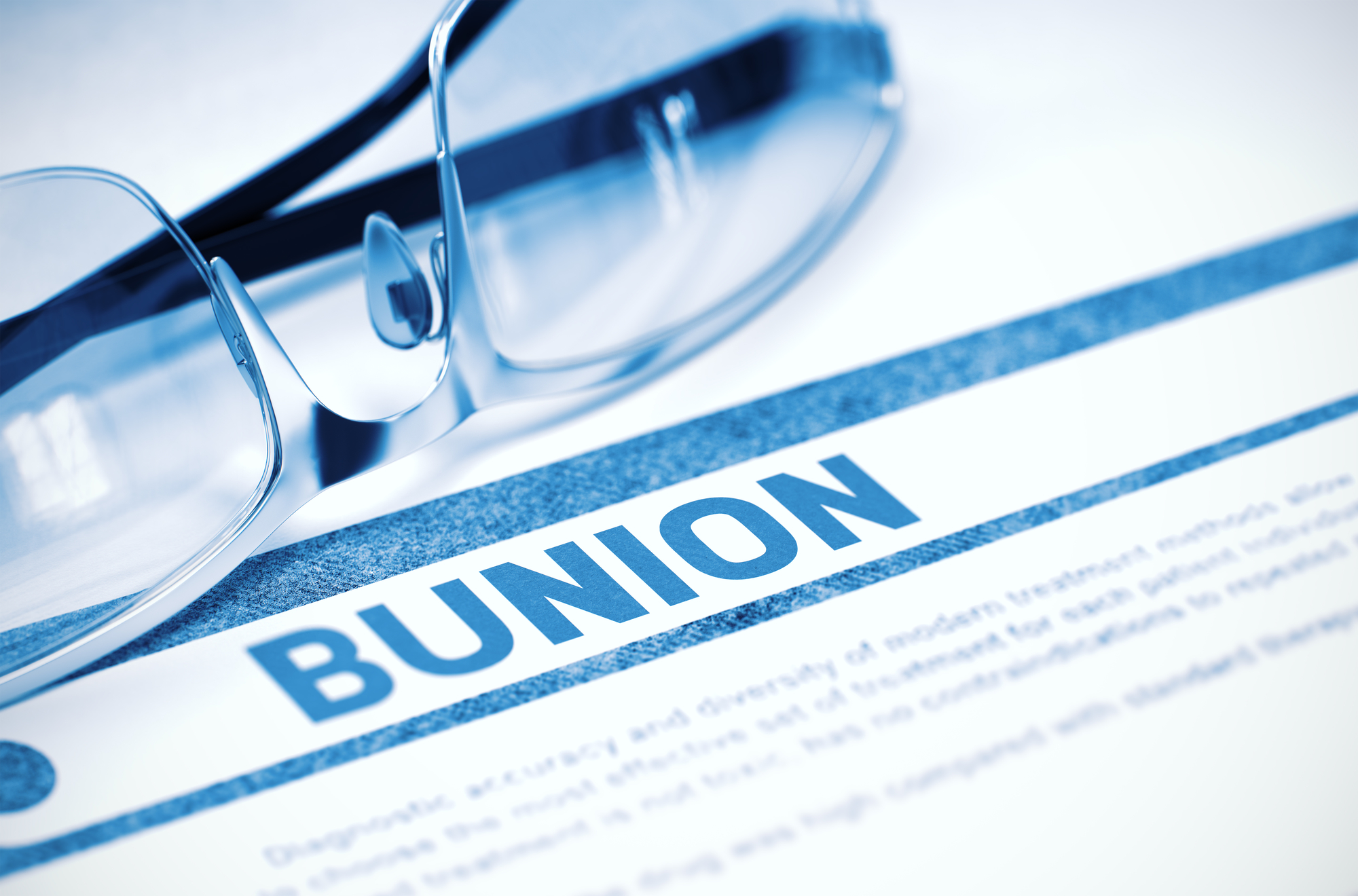 Dr. Elton's Ultimate Guide to Bunions
