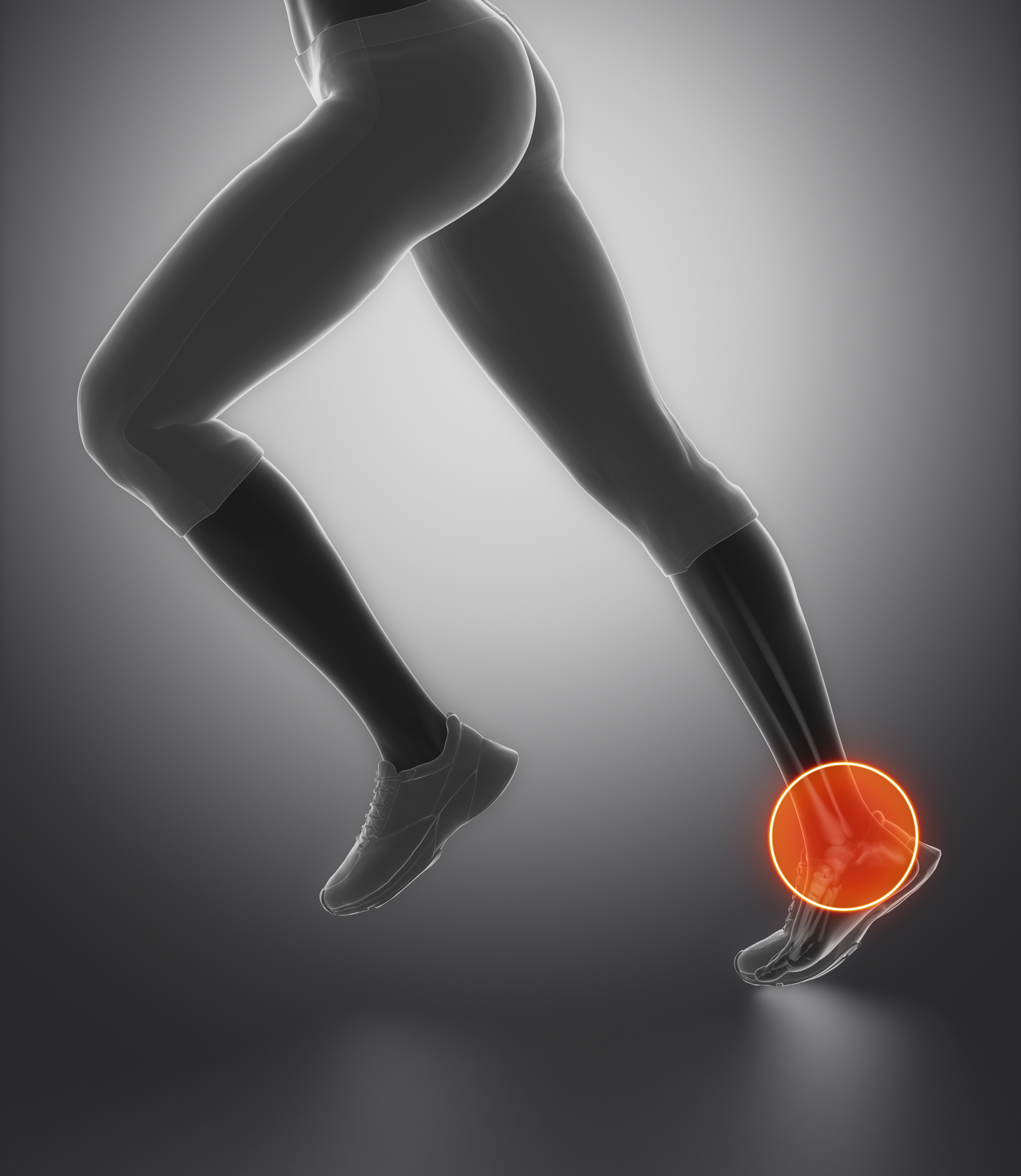 Achilles Tendon Pain, Ruptures, and Tendonitis