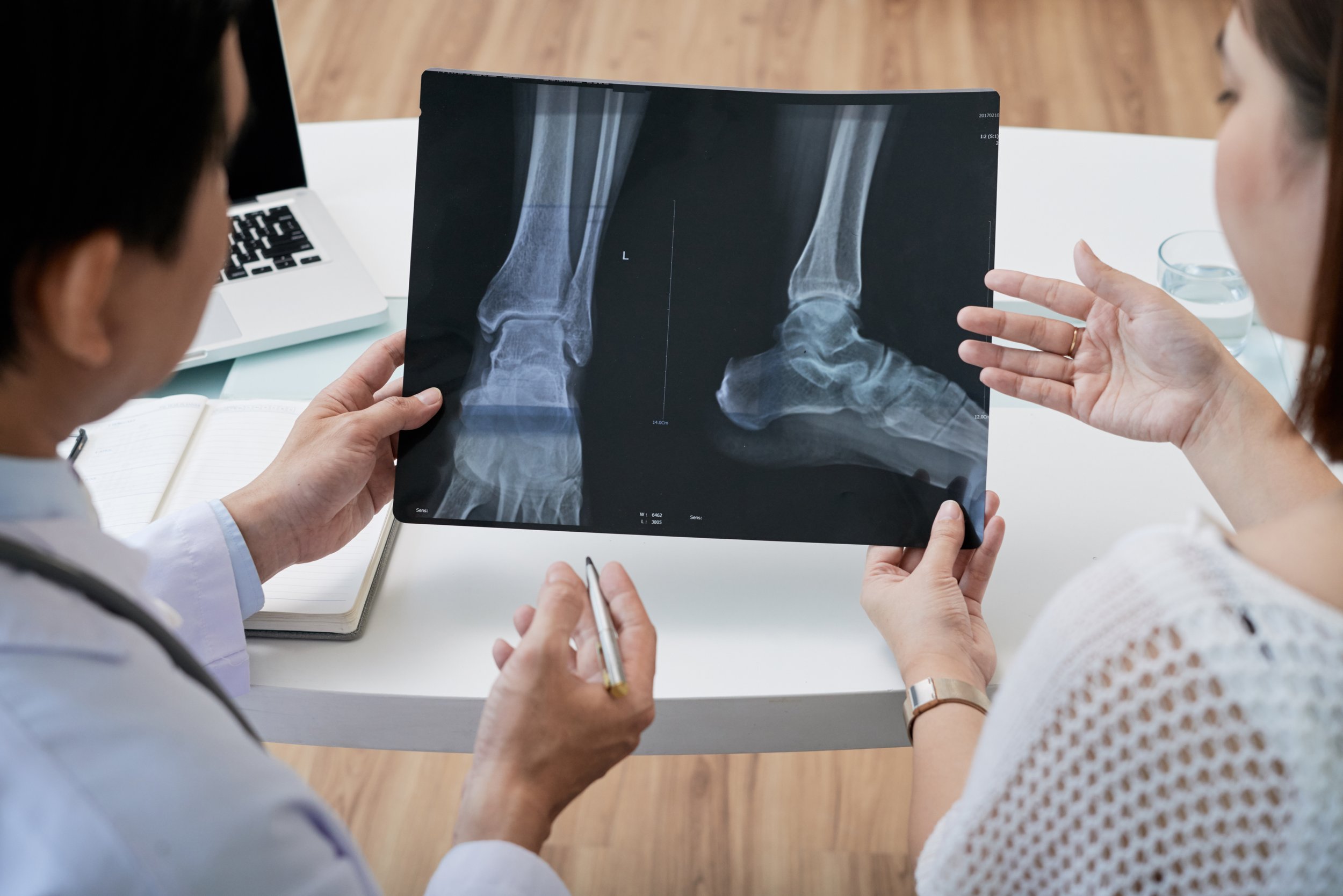 What to Expect After Achilles Tendon Surgery | Cornerstone Foot & Ankle