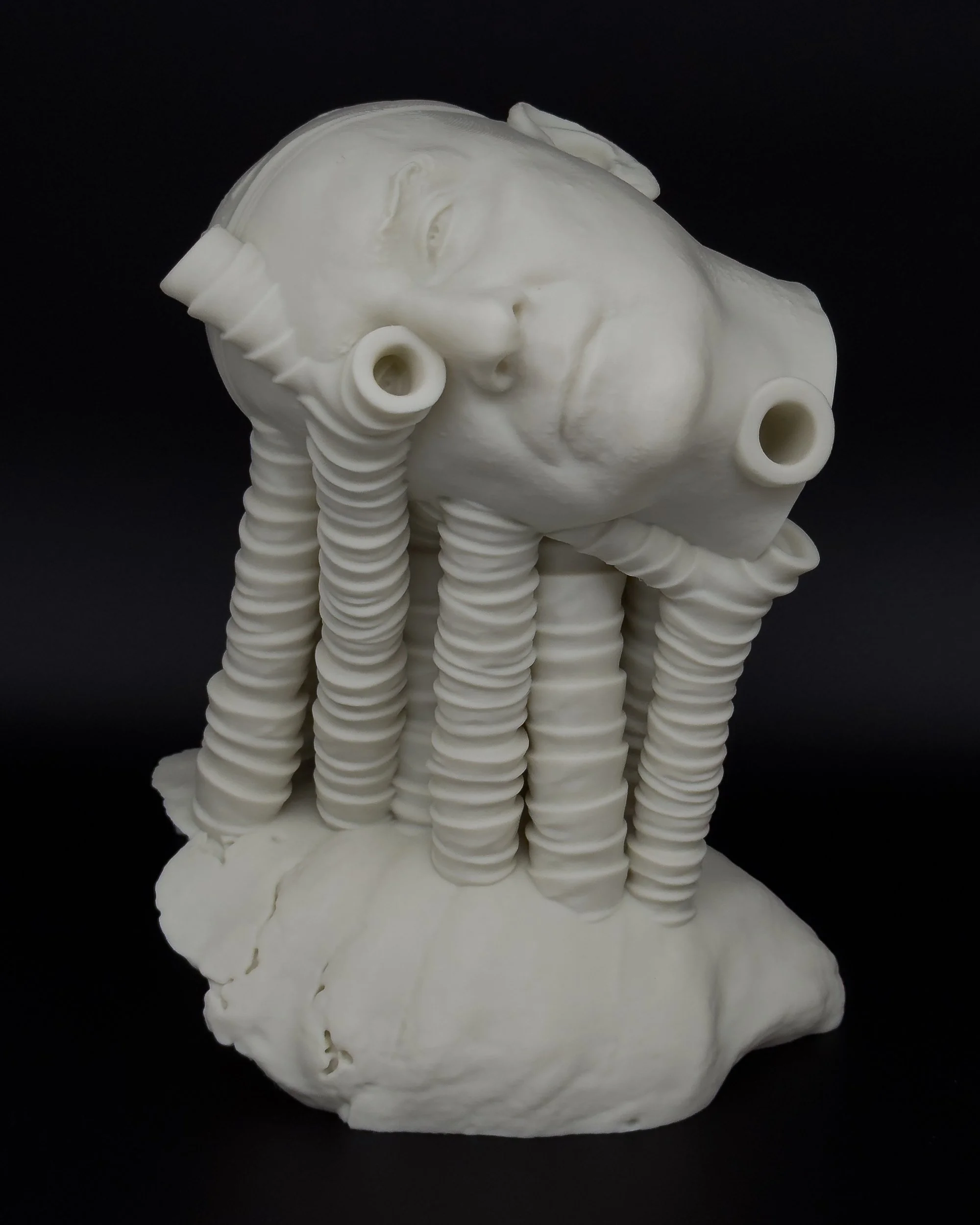 Trachea Support (2026). Bioplastic, 10 ½ x 9 ½ x 7 in.