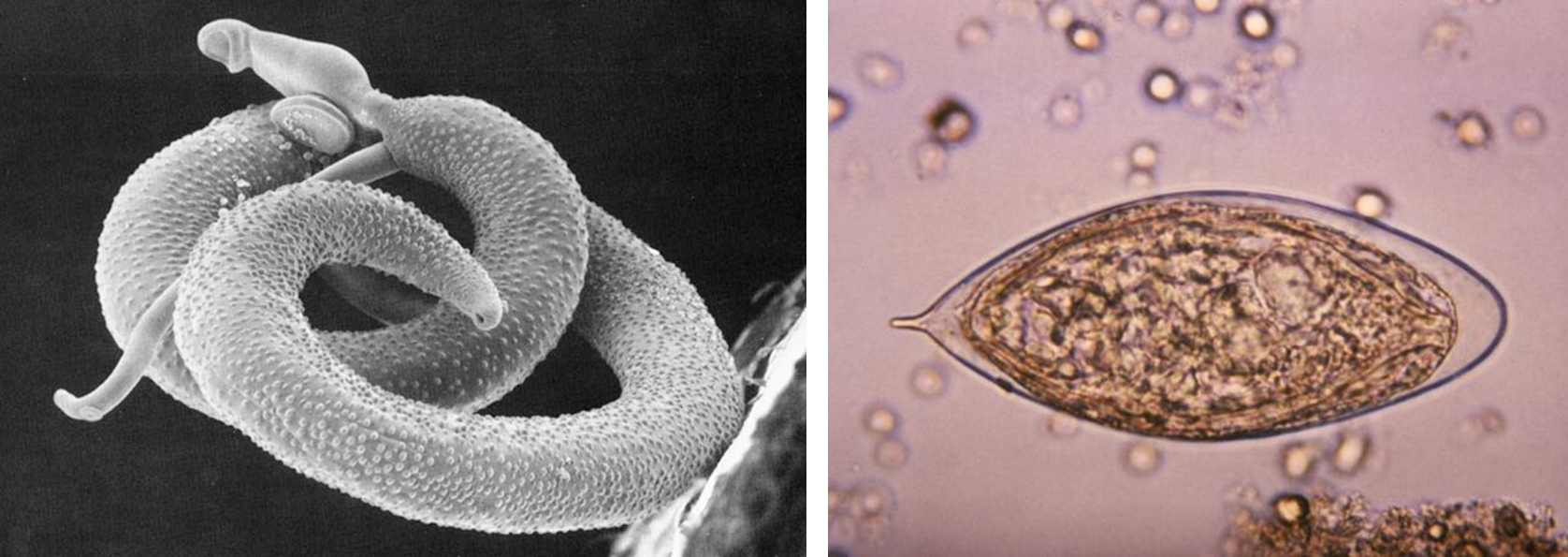 Figure 1. Left: A schistosome male (thicker) and female (thinner) worm in the process of mating. Right: Schistosome egg. Each egg has a sharp spine that is thought to help it penetrate through tissues and stick to organs.