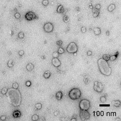 Transmission electron microscopy of exosomes