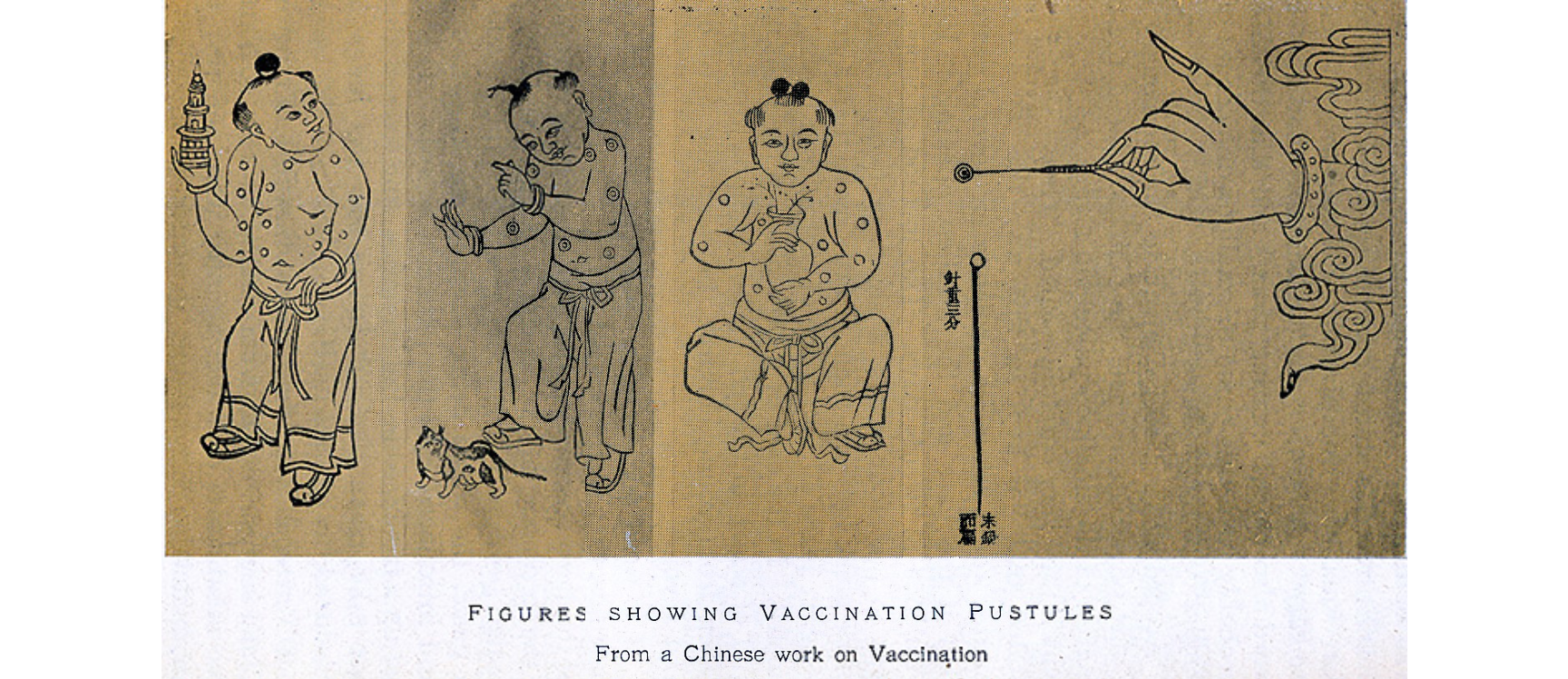 Figure 1: Chinese print showing vaccination, 1913 [10