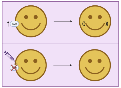 Botox and Botulism: Same Toxin, Very Different Outcomes