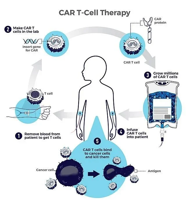 From Cells to Cures: How CAR-T, TCR, and TIL Are Transforming Cancer Care