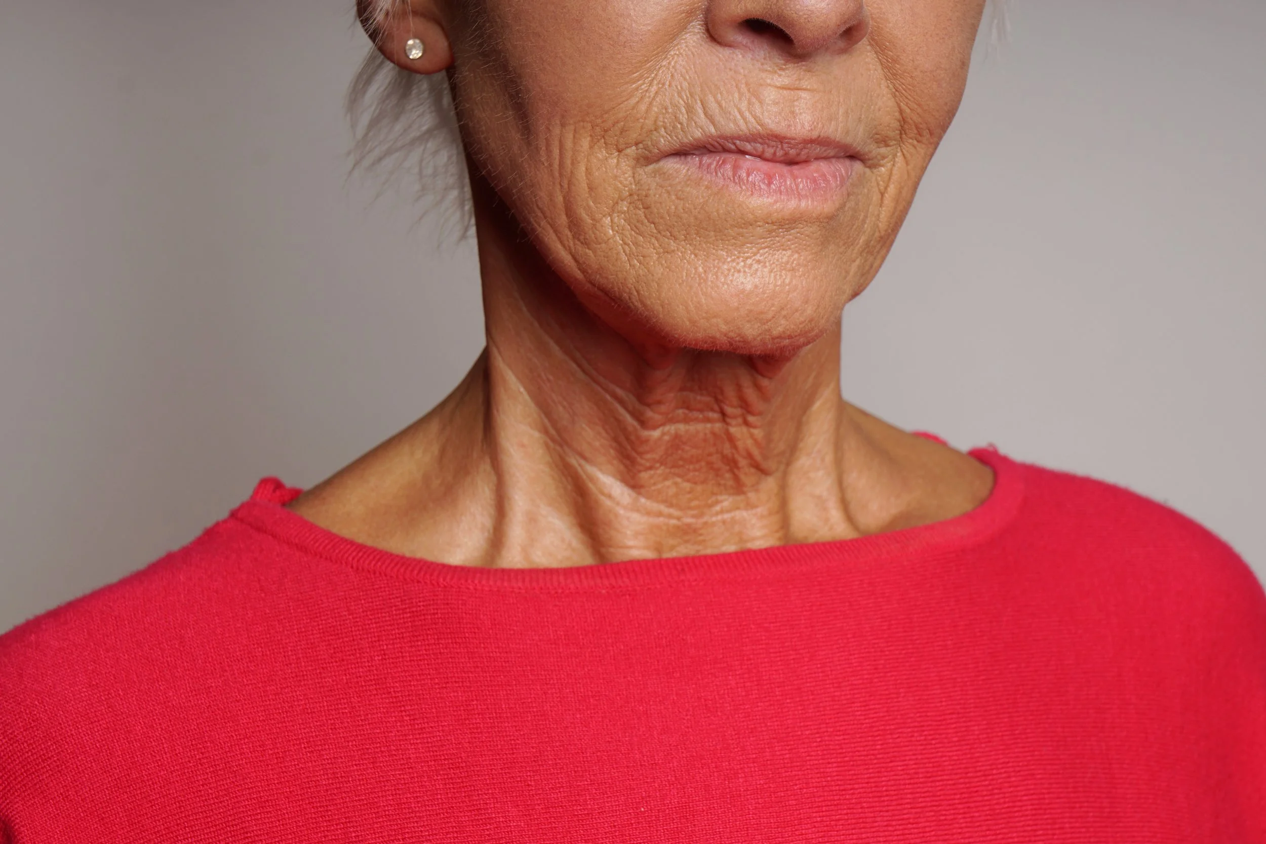 Skin Cancer Surgery