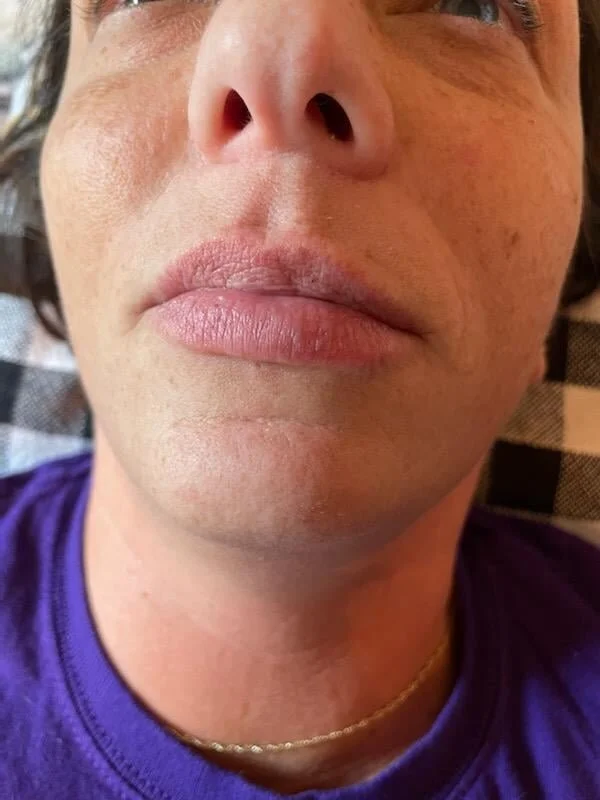 Close-up of a person's face showing their nose, lips, and chin, with some freckles and a gold necklace.