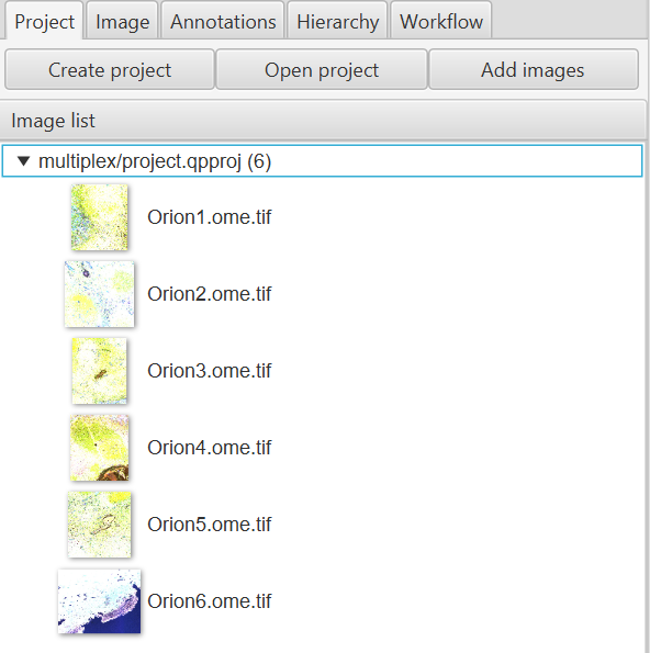 Creating a brightfield image analysis workflow — Image Scientist