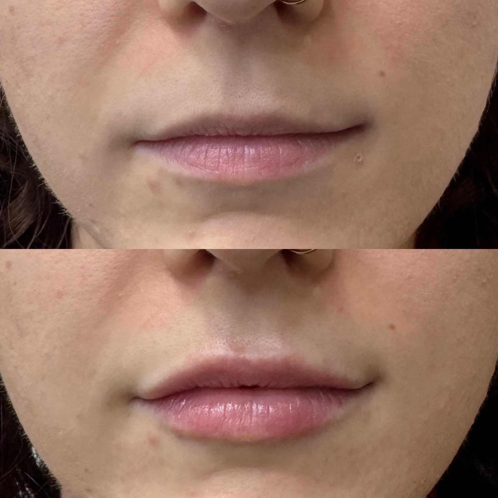 Lip Results