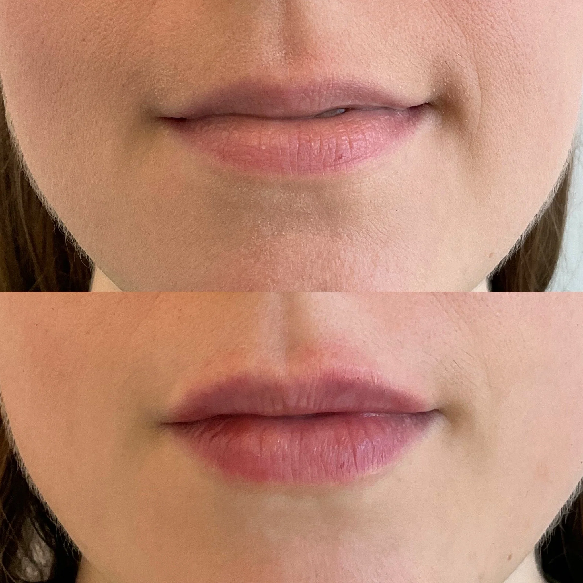 Lip Results
