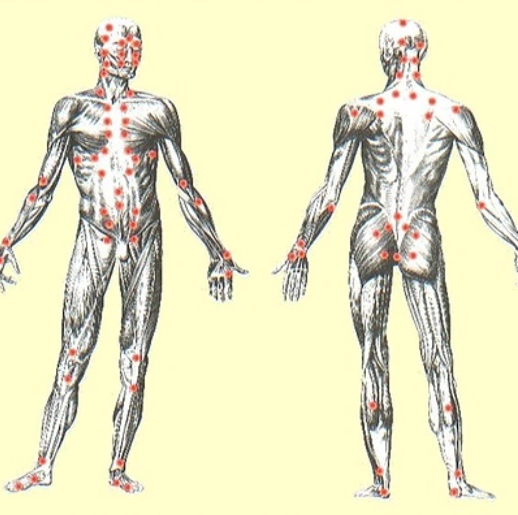 Illustration of the human muscular system showing front and back views, with red dots indicating pain points or key areas.