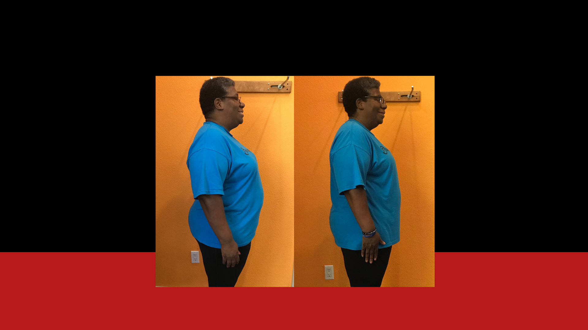 Side-by-side comparison of a woman before and after a posture correction, standing against an orange wall.