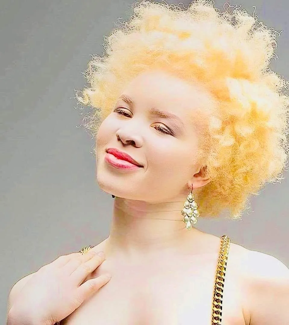 Blog- Black Albinoism.jpeg