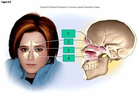 Waspadai Pilek Lama, Sinusitis mengintai