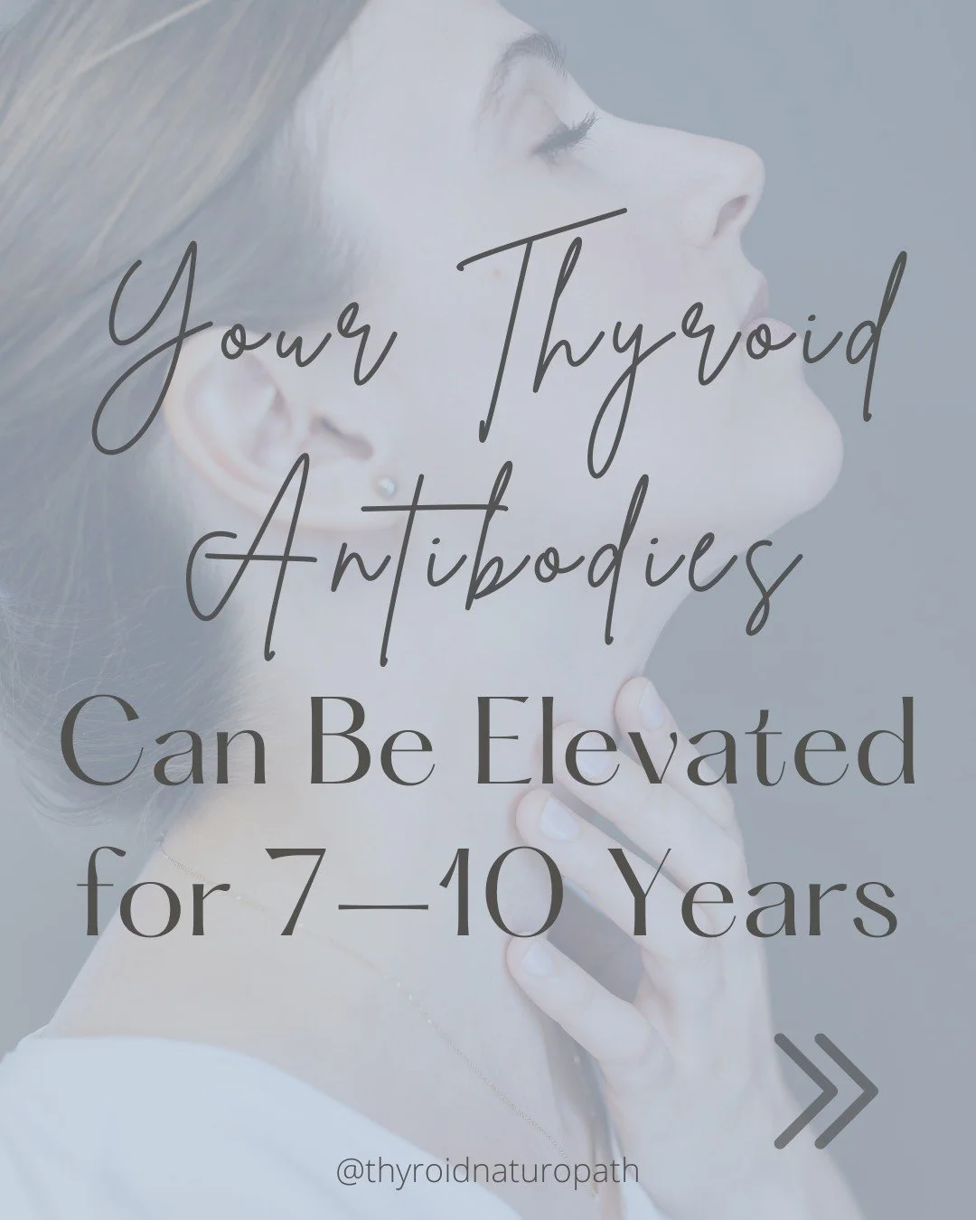 You can feel awful for years — tired, foggy, puffy, gaining weight — and still be told your thyroid labs are “normal.”
Here’s what most people never hear:
Your thyroid antibodies can be elevated for 7–10 years be