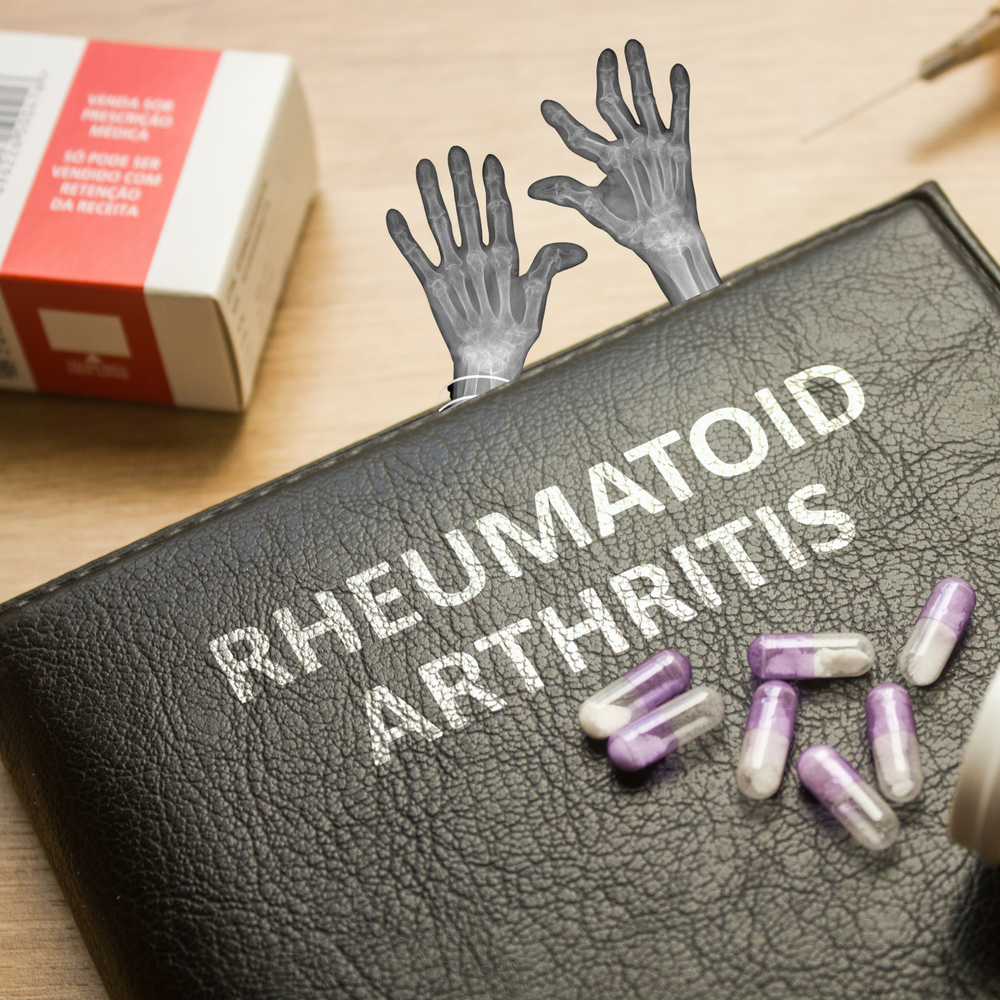 Rheumatoid Arthritis — Anchor Therapy Solutions, PLLC