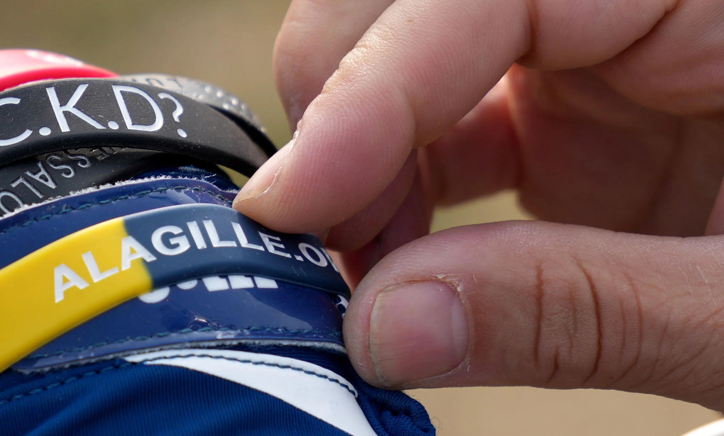  Eli Otero Jr. adjusts a wristband showing his son’s Eli Otero III’s genetic disorder Sunday, Sept. 8, 2024, near Lucas Oil Stadium in Indianapolis. 