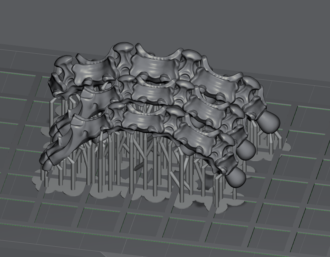 Preparing Plagia cuff to be printed in section in Lychee slicer 