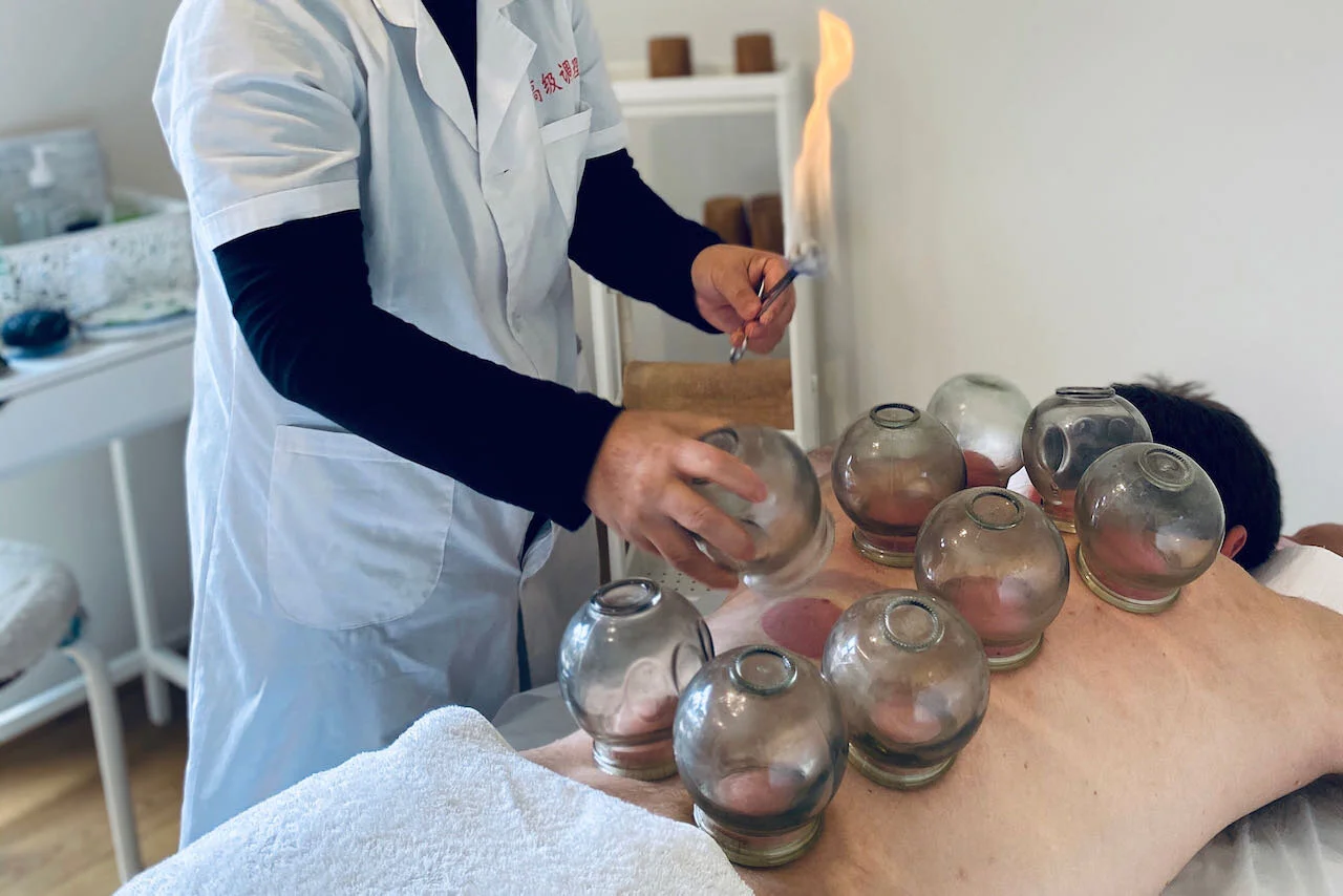 Cupping Therapy