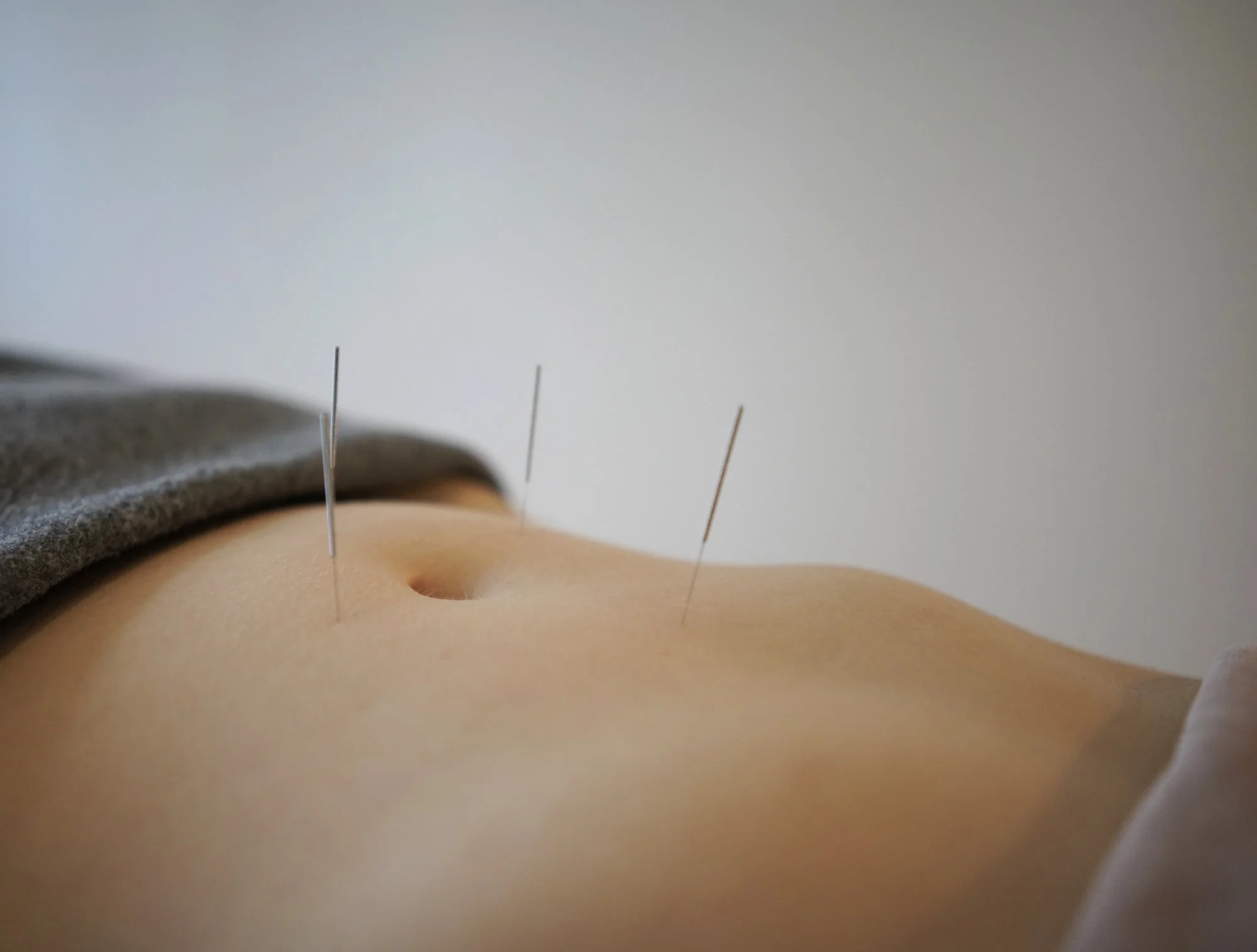 belly needles.jpg
