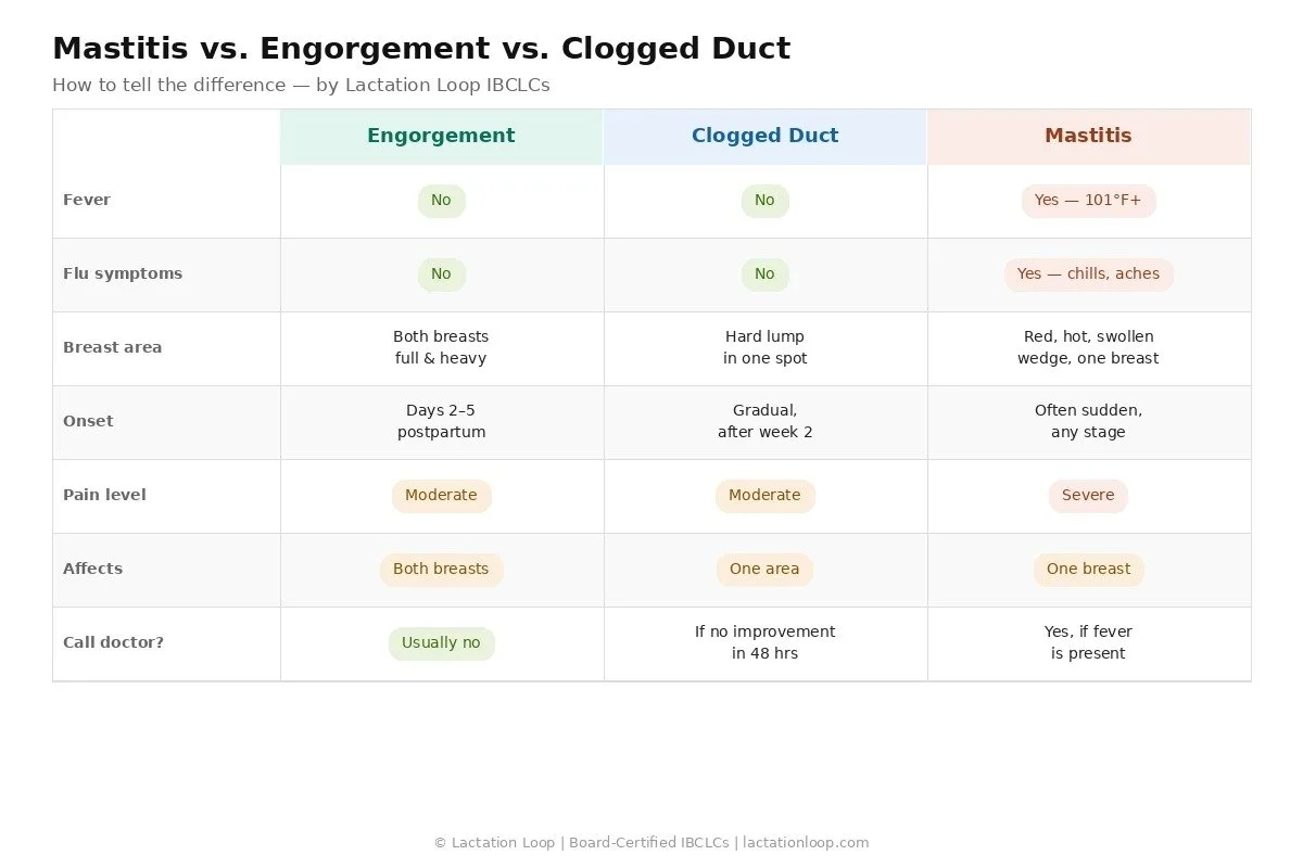 Mastitis vs engorgement vs clogged duct comparison chart showing symptoms, fever, onset and treatment differences — by Lactation Loop IBCLCs
