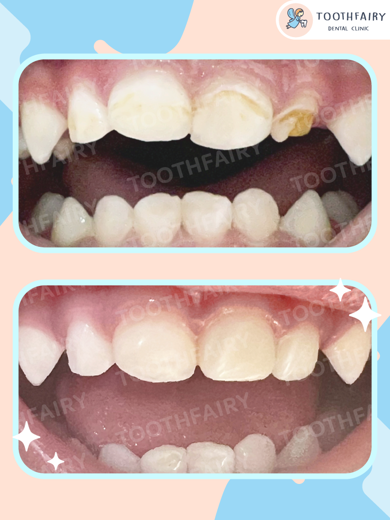 Tooth Fairy Dental Clinic - คลินิกเฉพาะทางด้านทันตกรรมเด็ก