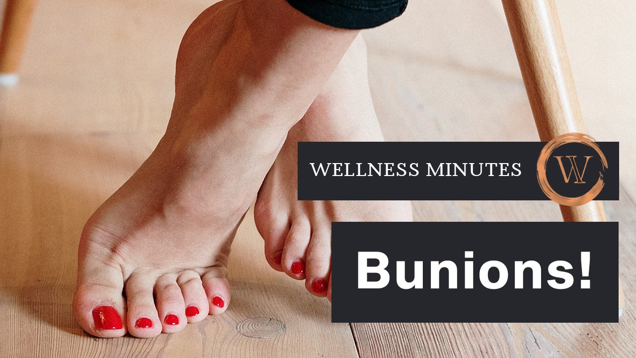 Bunions!