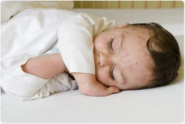 Maternal Diabetes Tied to Infection Risk in Infants