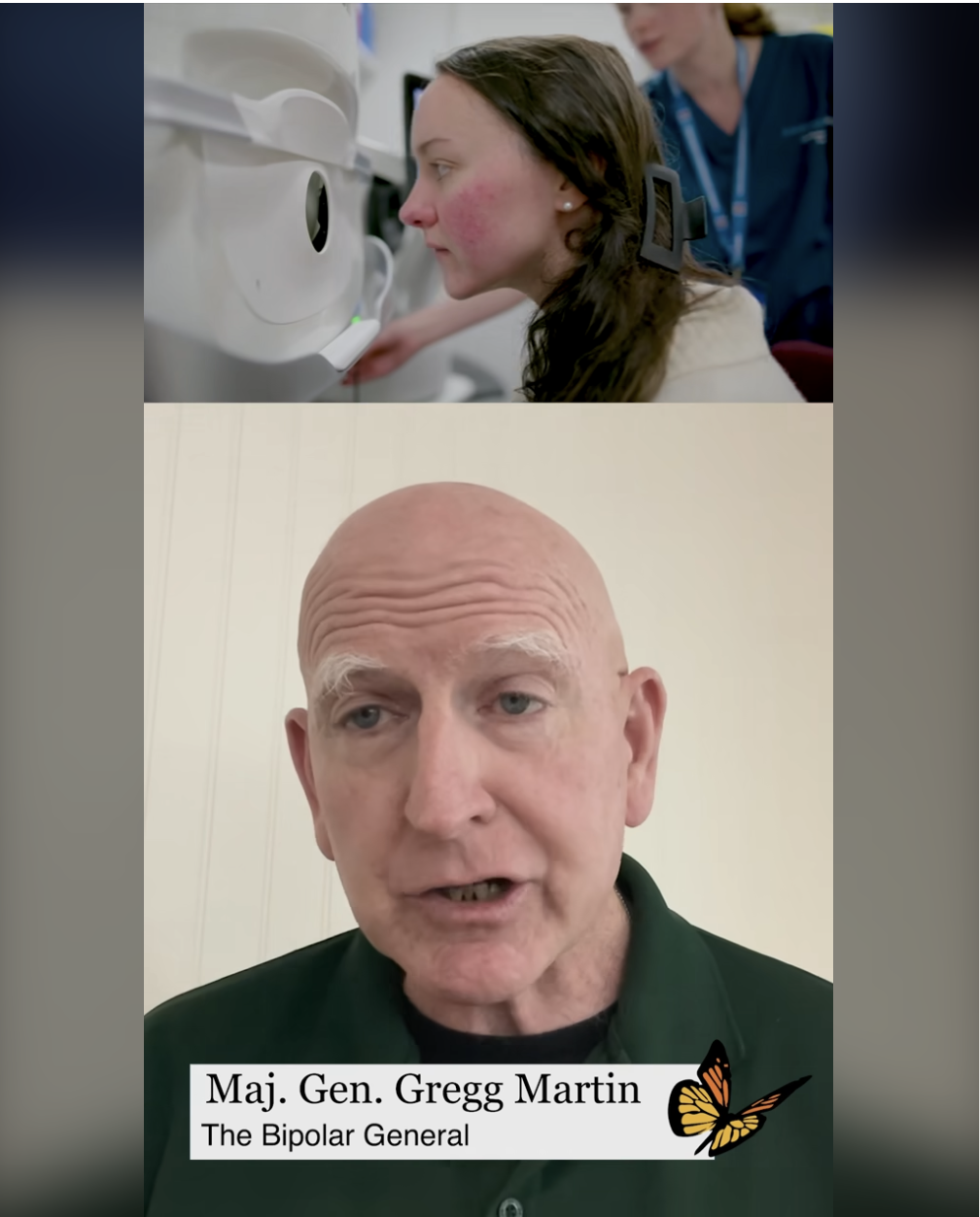 BrainStorm: From Broken to Blessed on the Bipolar Spectrum.