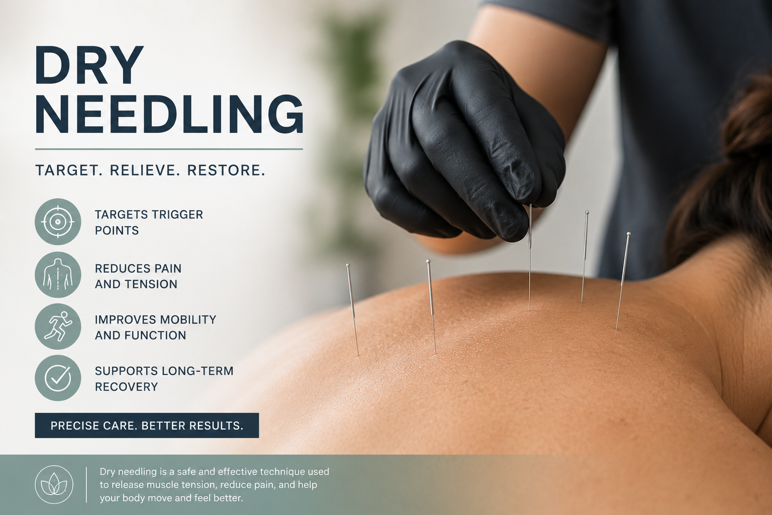 What is Dry Needling?