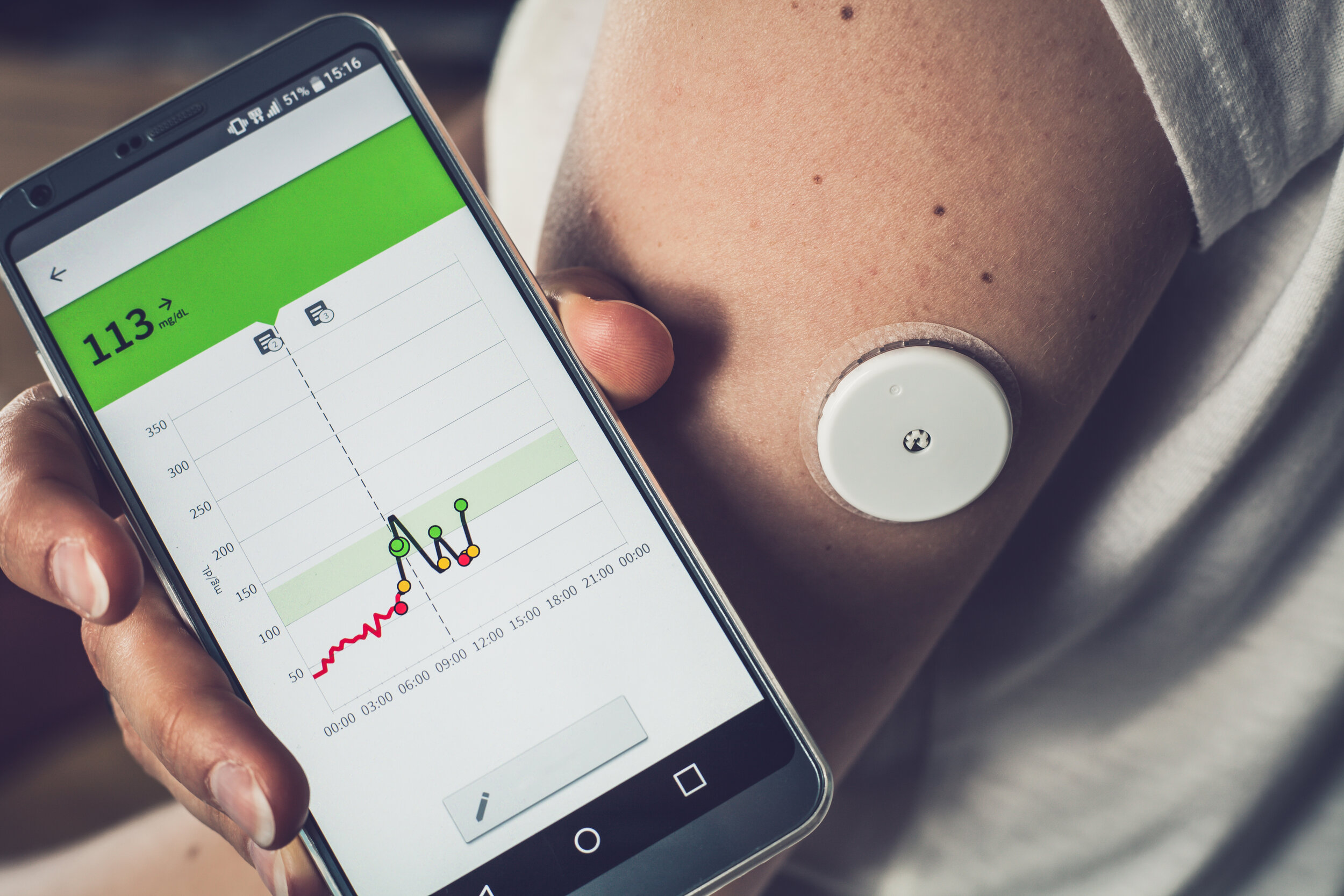 Remote Patient Monitoring How Wearable Devices Are Making An Impact In