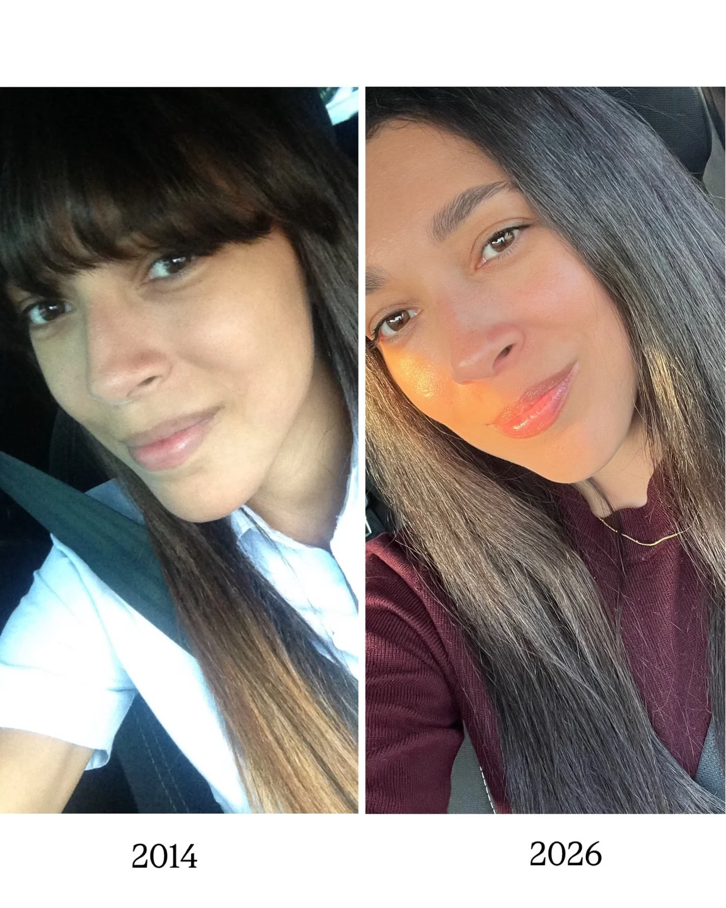 A los 27 no me ve&iacute;a mal.
Pero no me sent&iacute;a bien.

Estaba m&aacute;s cansada.
M&aacute;s inflamada.
M&aacute;s desconectada de mi cuerpo.

Y durante mucho tiempo pens&eacute; que eso era normal.

Hoy, a los 39, me veo m&aacute;s luminosa