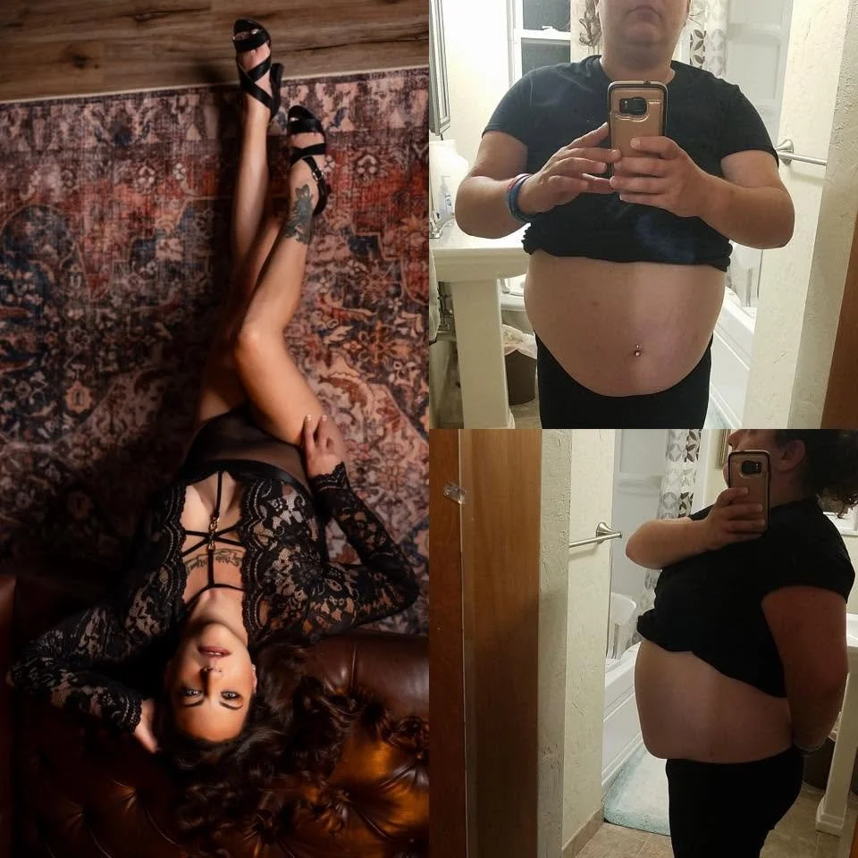 You Lost the Weight. Now Let's Help You See Yourself the Way Everyone Else Does.