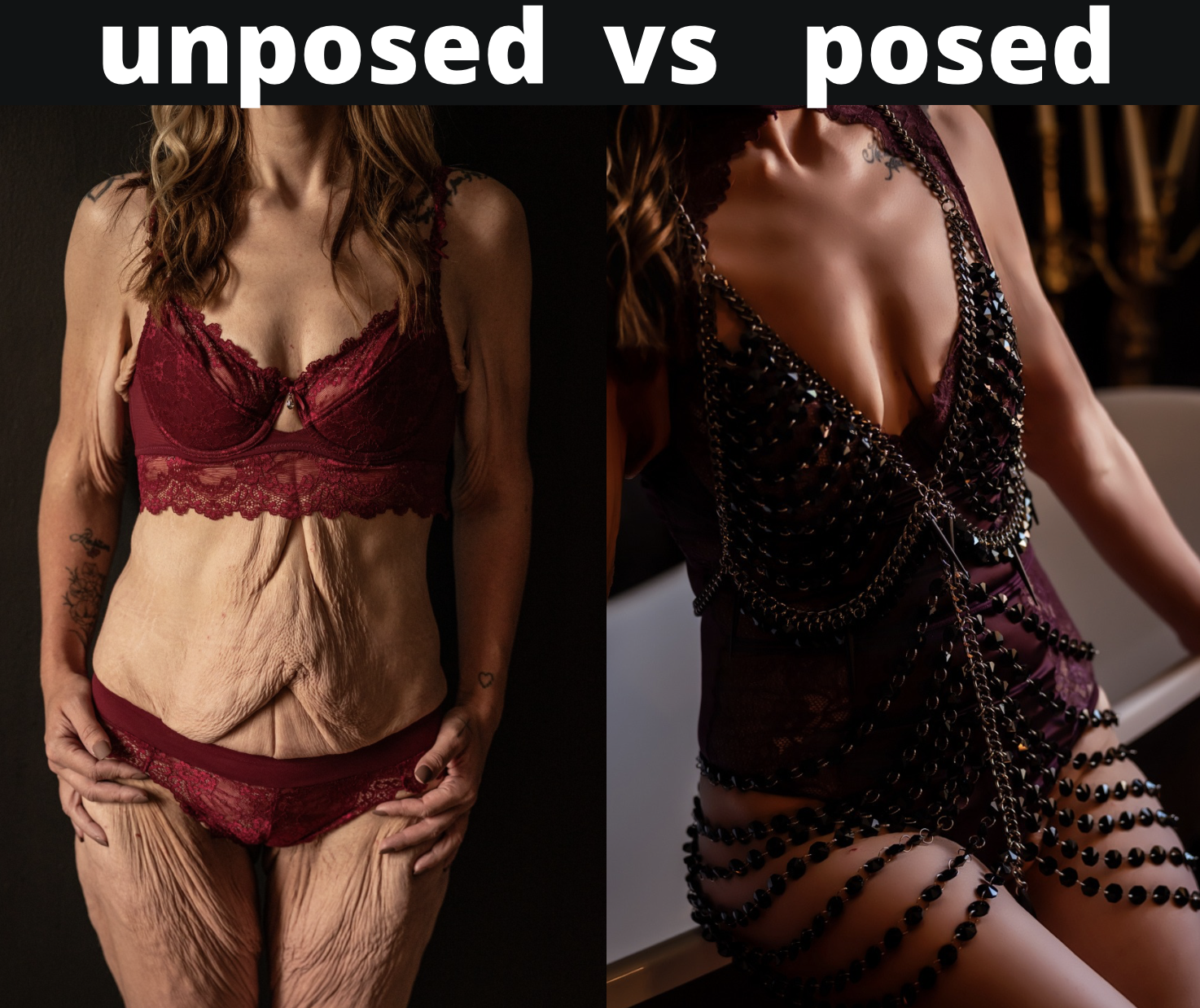 You lost the weight. Now let’s celebrate your new body. 