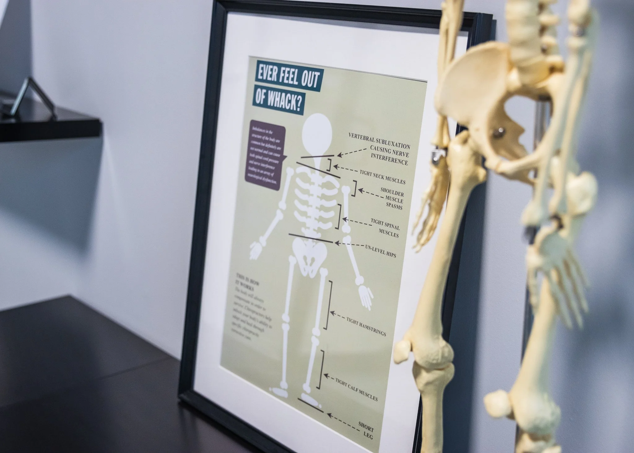 An educational poster titled 'Ever Feel Out of Whack?' showing skeletal issues like vertebral subluxation, tight neck muscles, shoulder muscle spasms, tight spinal muscles, unlevel hips, tight hamstrings, tight calf muscles, and short leg, with a mod
