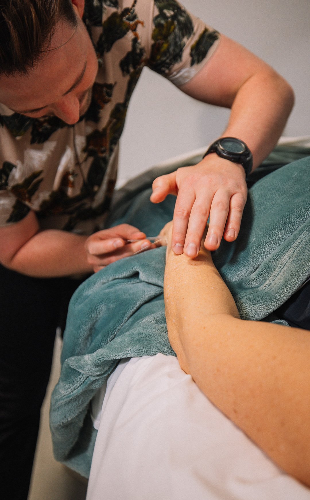 Acupuncture treatment