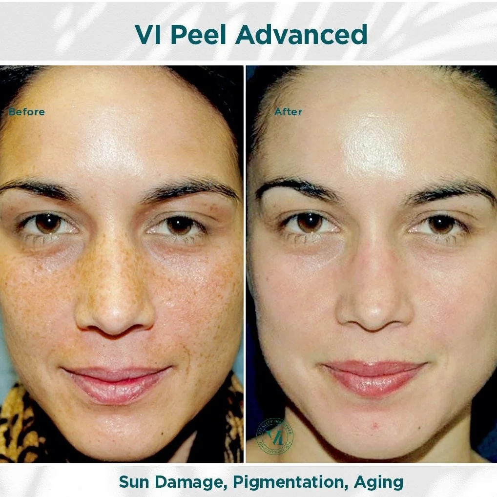 Sun+Damage%2C+Pigmentation+%26+Aging.jpg
