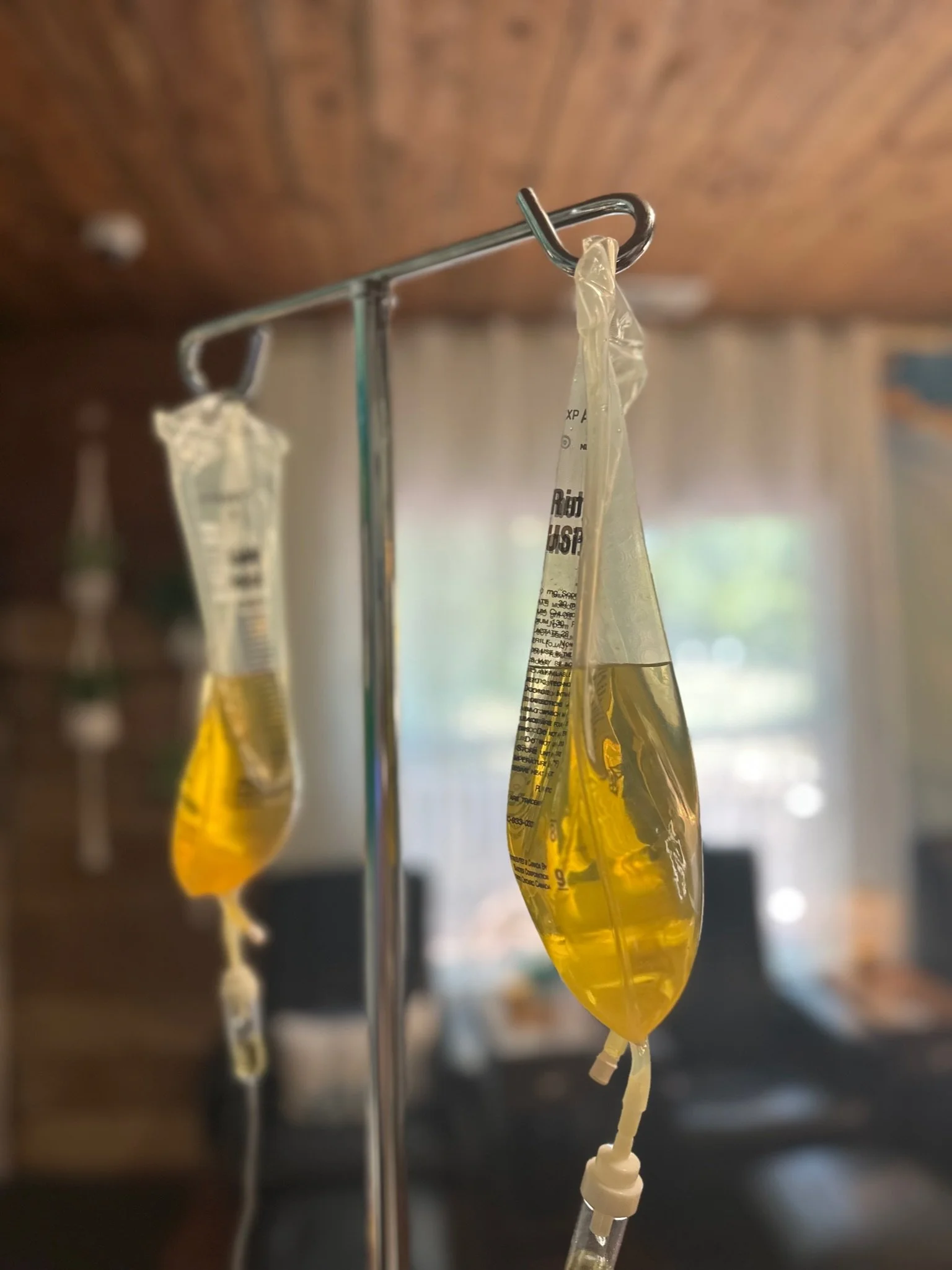 Double vitamin IV infusion to help with dehydration and heat tolerance at The Irenic Place in Aledo, Texas