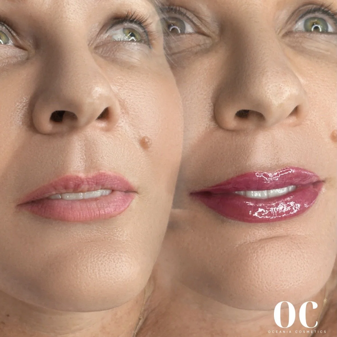 oc lips before and after.JPG