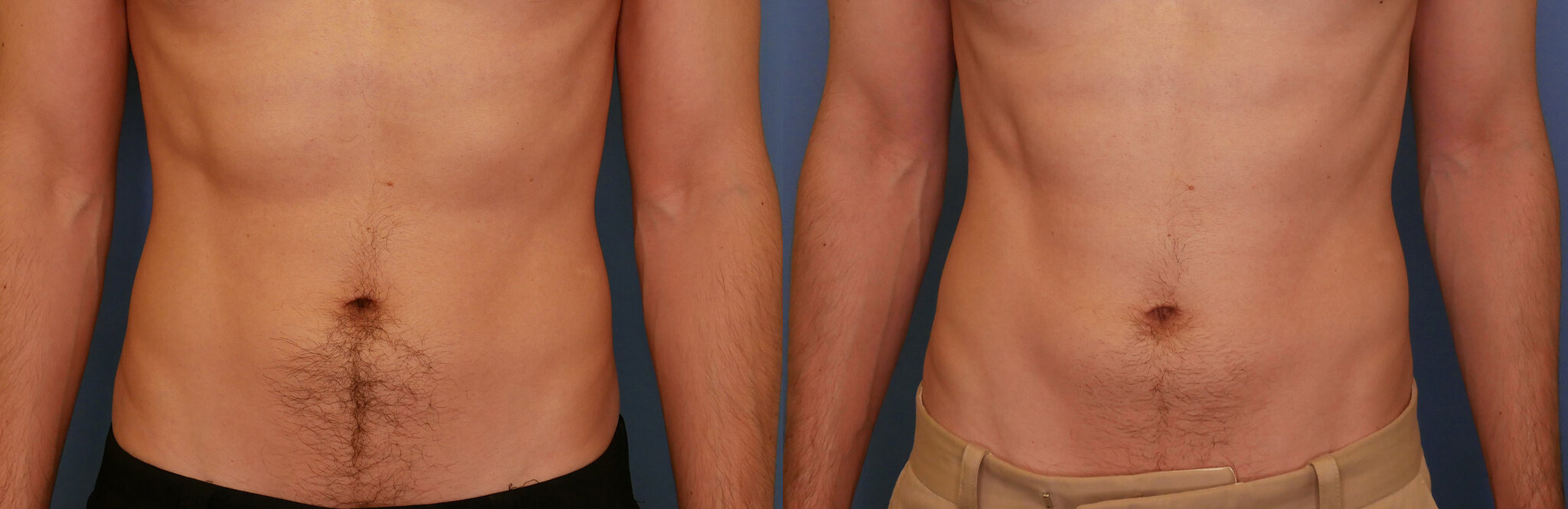 Bild: Nadir Qazi, MD