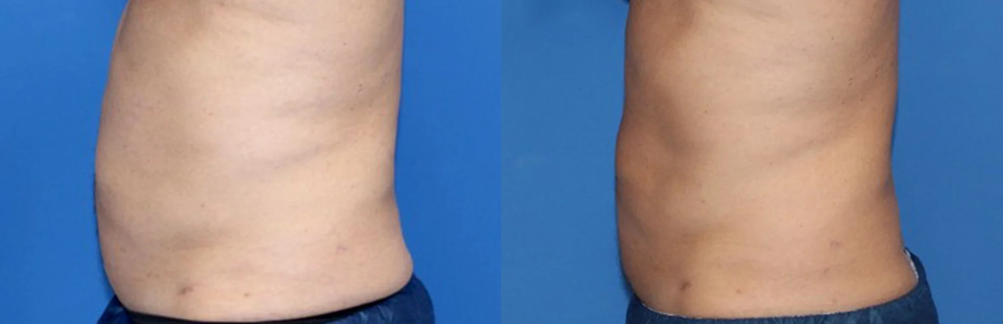 Bild: Somenek + Pittman