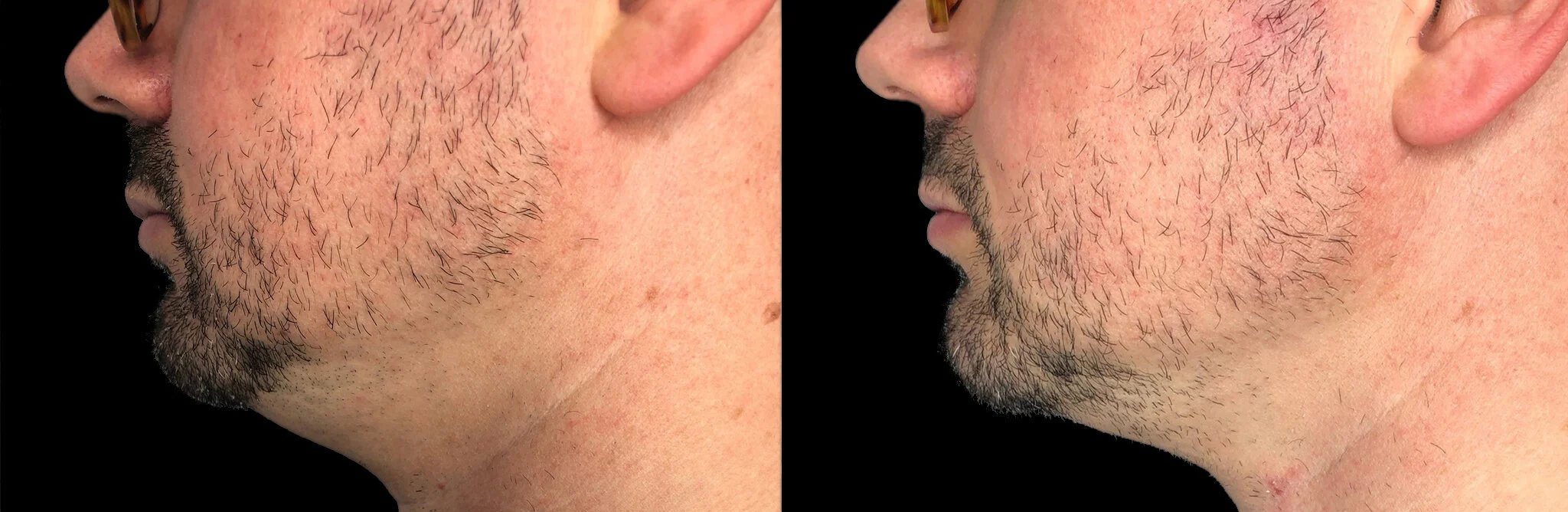 Bild: Ben Tracy, MD